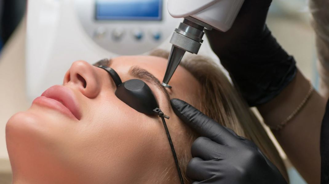 How to Remove Microblading Eyebrows