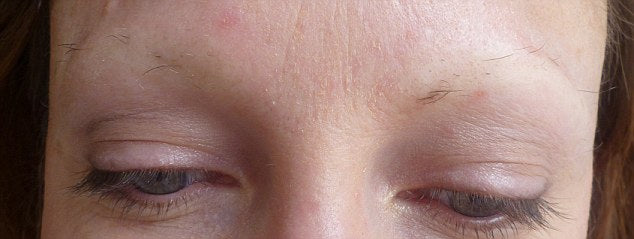 Why Are my Eyebrows Falling Out: Most Common Reasons