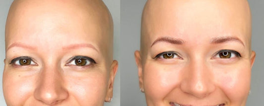 Sparse Eyebrows: How To Fix Thin Brows Permanently