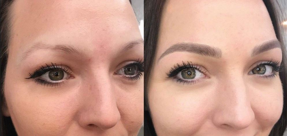Sparse Eyebrows: How To Fix Thin Brows Permanently 